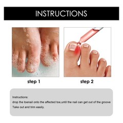 Ingrown Toenail Treatment Serum 10ml Toe Nail Repair Corrector Pain Relief Oil