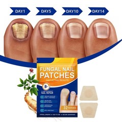 Renewal Fungal Nail Patches Patch Overnight Nail Repair for Nail Fungus Damage