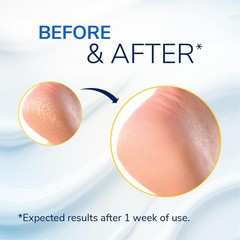 Dr. Scholl’s Severe Cracked Heel Repair Restoring Balm 2.5oz, with 25% Urea for