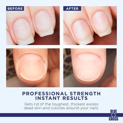 Cuticle Remover & Softener Liquid – Hydrating Treatment for Dry Cuticles, 32oz