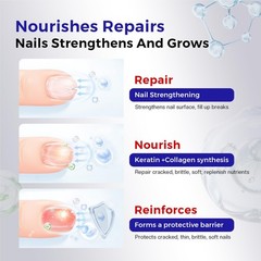 Morovan Nail Strengthener and Growth: 0.5 Fl Oz (Pack of 1), A1-milky white
