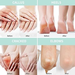 Grocerism Urea Cream 40 Percent For Feet Plus 2% 5.29 Ounce (Pack of 1), 40%