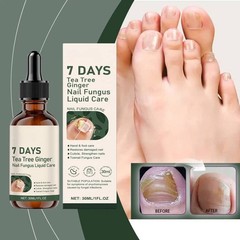 Nail Fungus Brightening Nourishing Nail Appearance Anti-fungal Nail Care Liquid