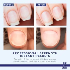 Cuticle Remover Cream for Dry Damaged Cuticles, Moisturizing Cuticle Softener fo