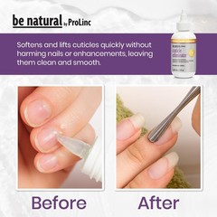 ProLinc Cuticle Eliminator – Instant 2 Fl Oz (Pack of 1), Clear