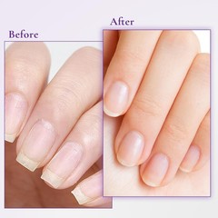 Nail and Cuticle Cream with Keratin Biotin and Ceramides Deep Hydration 15ml