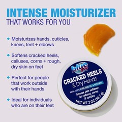 Blue Goo CRACKED HEELS & DRY HANDS Skin Softener 2 Ounce (Pack of 1), blue