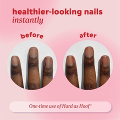 Onyx Professional Hard As Hoof Nail Strengthening 1 Ounce (Pack of 1), White