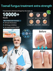 2026 Upgrade Toenail Fungus Treatment【GMP 0.34 Fl Oz (Pack of 3), White