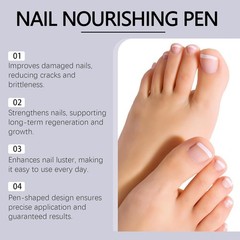 Toenail Fungus Pen, Nail 0.49 Fl Oz (Pack of 4), Purple