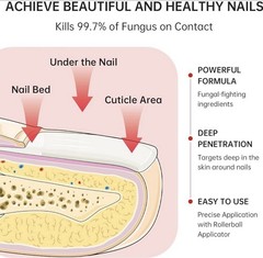 QQE Fungal Nail Treatment 7 Days+ Cream 1% Tolnaftate 0.51 fl oz / 15 ml