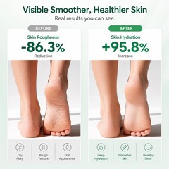 FAMIKYA Urea Cream 40 Percent for Feet Maximum 6 Ounce (Pack of 1), White