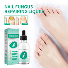 New Kerassentials Toenail Treatment Oil, Kerassentials for Toenail US