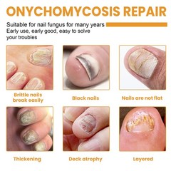 Nail Repair Patches Toenail Correction Strips Fungal Treatment Nail Care 32pcs