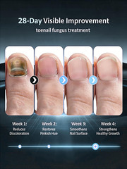 2026 Upgrade Toenail Fungus Treatment【GMP 0.34 Fl Oz (Pack of 3), White