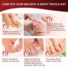 DERMFREE Toenail Treatment,Gentle Formula, 0.5 Fl Oz (Pack of 2), red