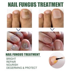 Nail Repair Liquid 30ml, Thick & Weak Nail Treatment, Moisturizing Care
