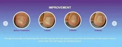 EMTRIX 10ml Anti-Fungal Nail Treatment Toenail Fungus Care Solution Healthy nail