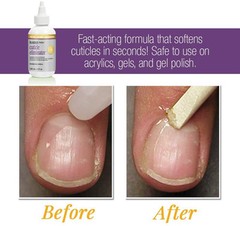 ProLinc Cuticle Eliminator 4 Ounce Softens Thick Cuticles for Manicures Pedic…