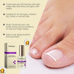 Nail Care Liquid Hand and Foot Nail Corneous Soft Nail