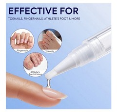Extra Strength Nail Care Solution: Natural Formula Complete Nail Restoration Kit