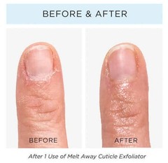 butter LONDON Cuticle Remover Liquid, Melt Away – Cuticle Oil Exfoliator 0.4OZ