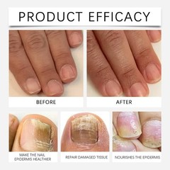 2ml Nail Care Solution Set Improve Soft Nails Moisturize Cuticles Repair Nails