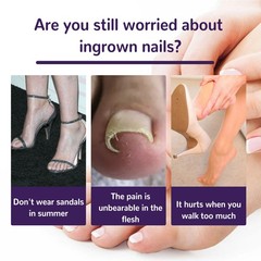 Ingrown Toenail Patch Elastic Nail Corrector Strip Non-Woven Toenail Care Tape