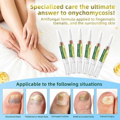 Toenail Fungus Treatment Pen Extra Strength – 0.17 Fl Oz (Pack of 6), White