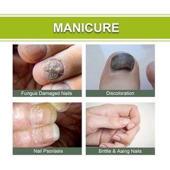 Nail Repair Gel Strengthening Treatment for Damaged Toe and Fingernails