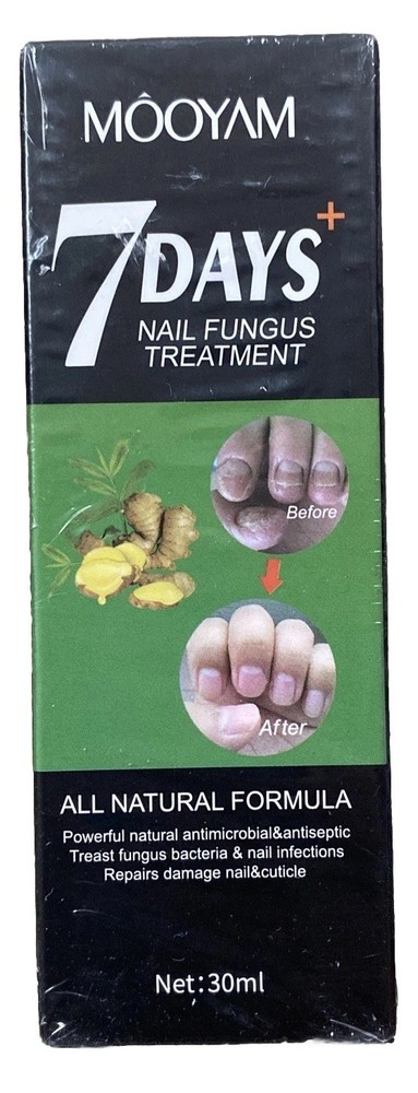 7 Days Nail Fungus Treatment All Natural Formula Gingers Nail Toenail Care 30ml