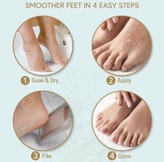 New Sealed LOVE LORI Foot Callus Remover Gel (6oz) – 6 Ounce (Pack of 1), Clear