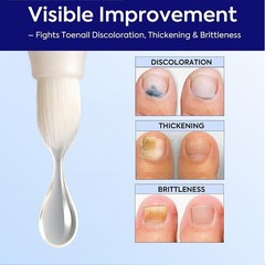 Extra Strength Nail Care Solution: Natural Formula – Complete Nail Restoratio…