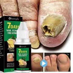 Extra Strong Nail Fungus Treatment Serum Essence Oil Feet Nails Repair Care Esse