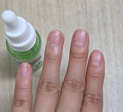 RING RING Your Solution Total Ampoule 30ml Nail Care Vitamin C, E Protein NEW
