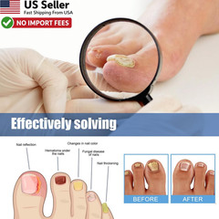 60PCS Fungal Nail Patches Toenail Fungus Treatment Hydrogel Repair Pads FROM USA