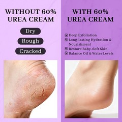 Clyecfra 5-in-1 60% Urea Cream with 2% Salicylic Acid, 60 Percent…
