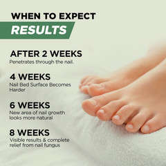 Foot Cure Toenail Fungus Treatment Extra 0.5 Fl Oz (Pack of 1), Multi-Colored