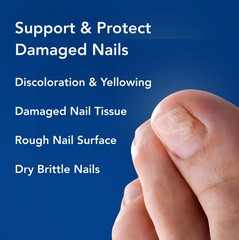PatchRX Nighttime Renewal Fungal Nail Patches – 1 Count (Pack of 36), Beige