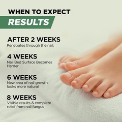 Foot Cure Toenail Fungus Treatment Extra Strength – Nail Repair Cream