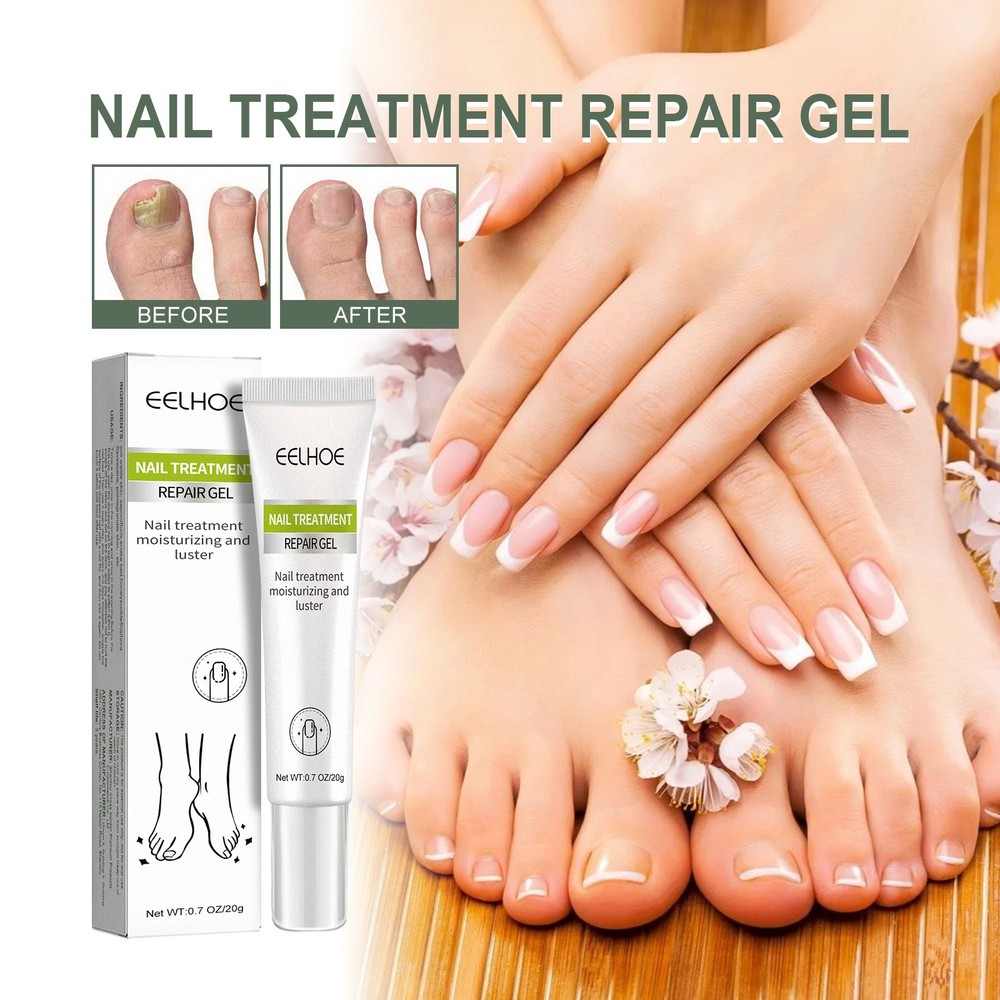 Nail Repair Gel Strengthening Treatment for Damaged Toe and Fingernails