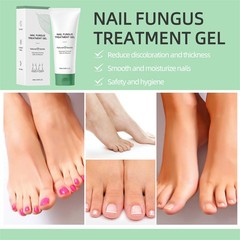 Nutraboost Nail Fungus Treatment Gel, Nail Fungus, Fungus Cream NEW 2026