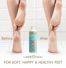 New Sealed LOVE LORI Foot Callus Remover Gel (6oz) – 6 Ounce (Pack of 1), Clear