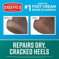 O’Keeffe’s for Healthy Feet Intensive Healing 2.2 Ounce (Pack of 1), White