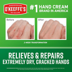 Working Hands Hand Cream for Extreme Dryness – 7 Oz Tube (2 Pack) – Repairing Sk