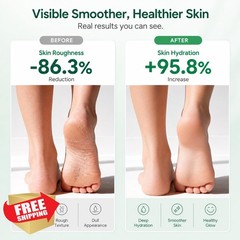 FAMIKYA Urea Cream 40% Feet 6 Ounce
