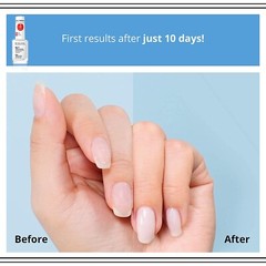 Total Action 8 in 1 Intensive Nail Conditioner (12 ml)