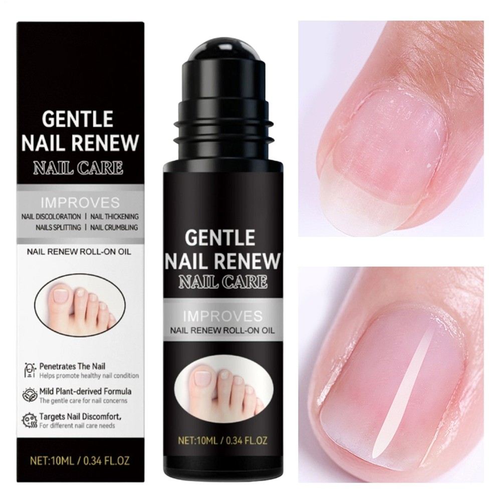 Nail Fungus Care For Toenail Nail Care Roll-on Oil Anti Fungal Effective Against