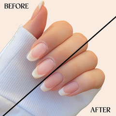 Sweet Almond Cuticle Oil for Nails – Repairs Cuticles Overnight – Moisturizes…