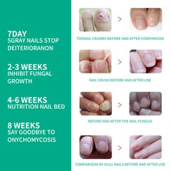 Kerassentials Toenail Treatment Oil Nail Care Repair Liquid Formula